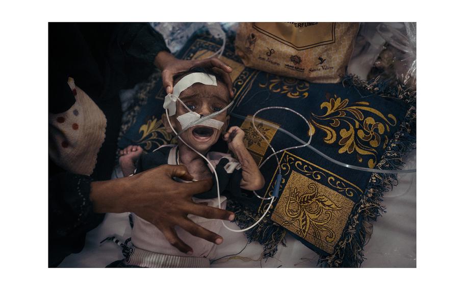 A child in the pediatric emergency ward.