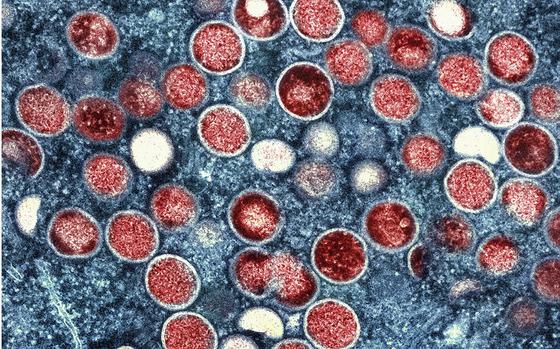 A colorized transmission electron micrograph of monkeypox particles (red) found within an infected cell (blue), cultured in the laboratory that was captured and color-enhanced at the NIAID Integrated Research Facility in Fort Detrick, Md.