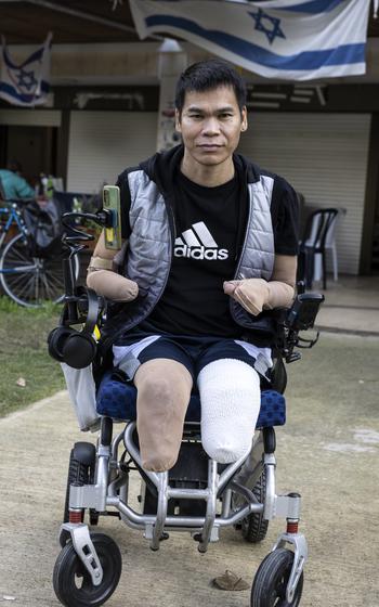 A Thai farmworker is seen in a wheel chair with both legs and a hand amputated.