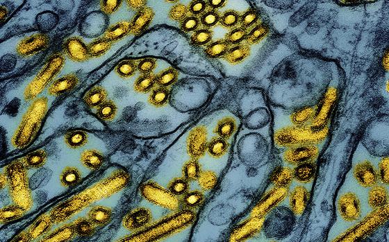 FILE - This colorized electron microscope image released by the National Institute of Allergy and Infectious Diseases on March 26, 2024, shows avian influenza A H5N1 virus particles (yellow), grown in Madin-Darby Canine Kidney (MDCK) epithelial cells (blue). (CDC/NIAID via AP, File)