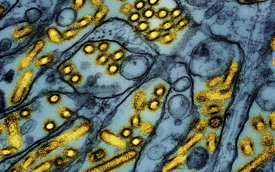 A colorized electron microscope image of bird flu cells