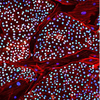 A colony of Asian elephant stem cells produced by Colossal Biosciences. 