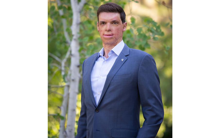 Brown poses in a suit without a tie standing next to a tree.