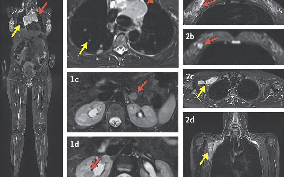 MRI images showing a mother to be.