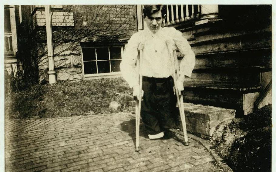 A 14-year-old coal miner in West Virginia had his legs cut off by a motor car inside a mine. Lewis Hine photographed him in 1910.