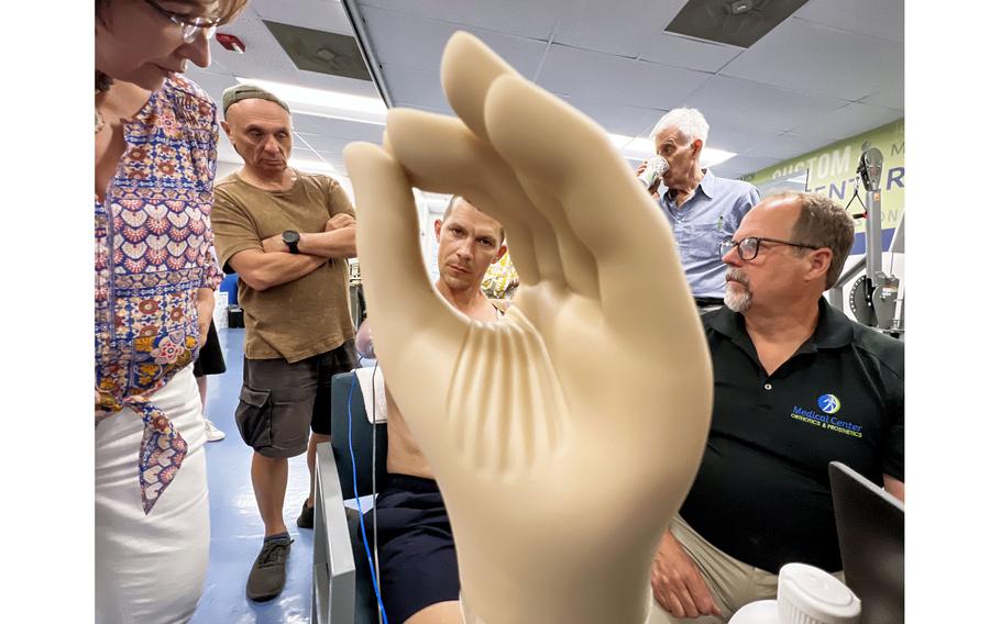 Ilia Mykhalchuk practices operating a prosthetic hand with his remaining muscles at Medical Center Orthotics and Prosthetics. 