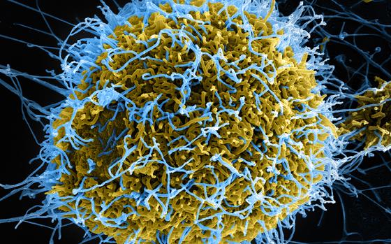 Electron micrograph of Ebola particles budding from an infected cell.