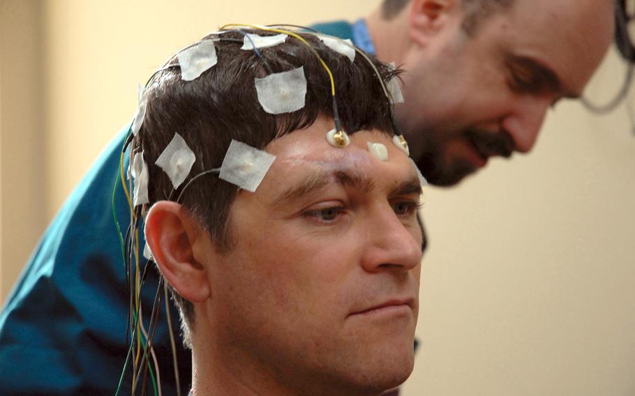 Staff Sgt. Dominic Annecchini gets hooked up for an electroencephalogram, of an EEG, to test the electrical activity of his brain before getting a cranioplasty at Walter Reed in January. In this photo he is missing his forehead.
