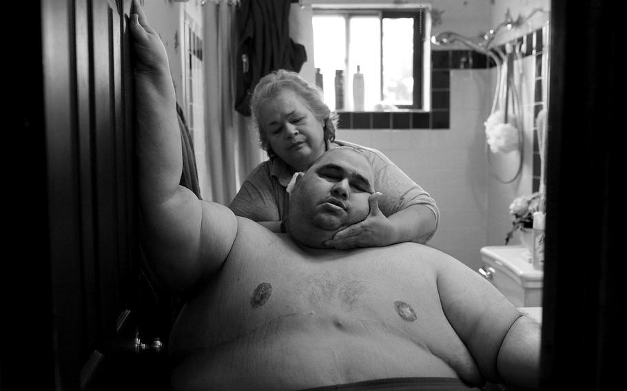 Lisa Krantz, "A Life Apart: The Toll of Obesity 1" | At almost 600 pounds, Hector Garcia Jr. finds simple daily tasks like bathing a challenge. He struggled to walk across the hall from his bedroom to the bathroom so that his mother, Elena, could wash him after having cut his hair in November 2010. A month before, Hector started dieting after he realized he was close to his highest known weight, 636 pounds. 