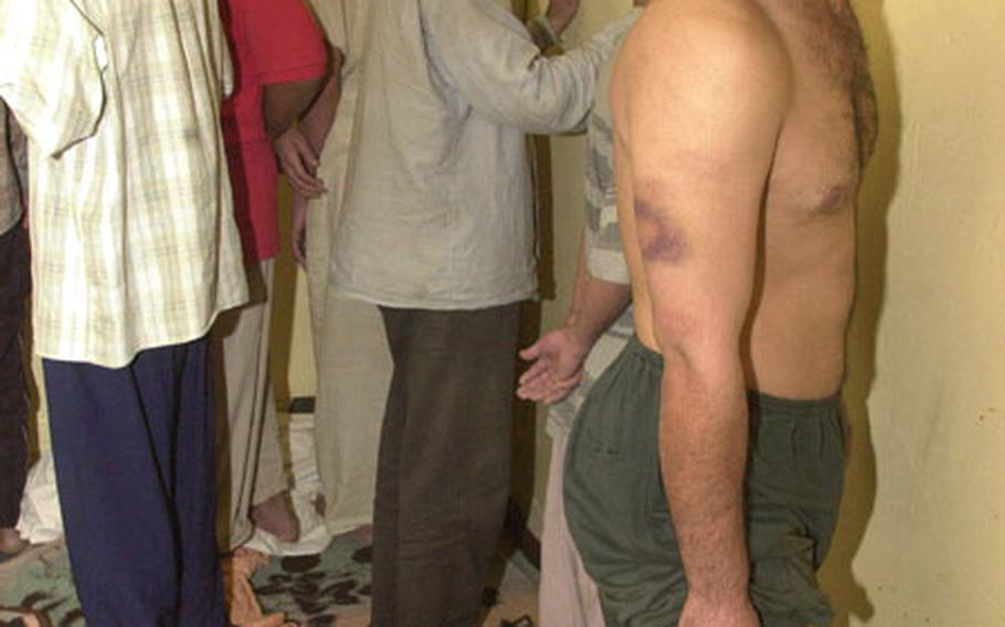 An Iraqi prisoner shows bruises on his arms and legs following a U.S. military raid of the Iraqi police station Friday in Sabi Abor, Iraq.
