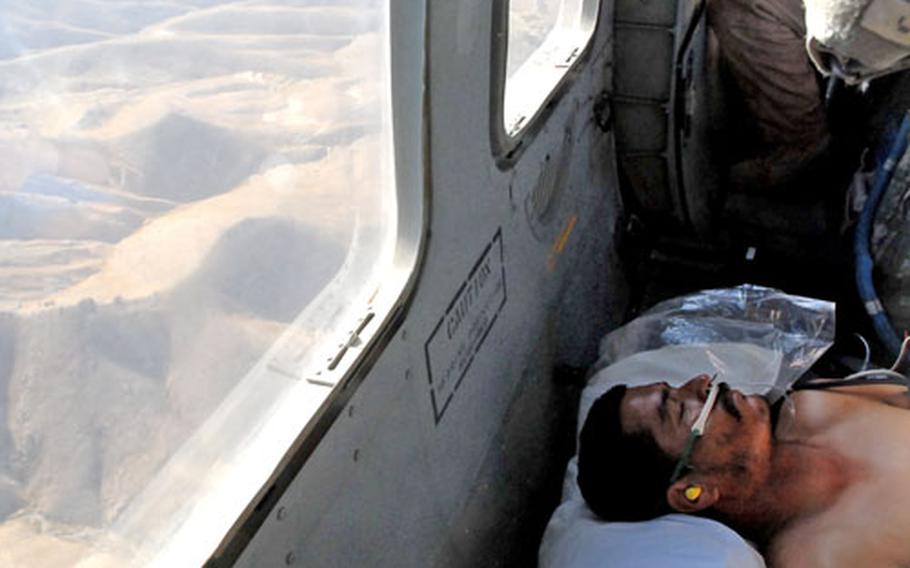 An Afghan soldier wounded by mortar fire is evacuated to a U.S. hospital at Bagram Airfield. More than half of U.S. medevac flights are made to evacuate Afghan security personnel and civilians. With little medical infrastructure outside Kabul, the flights often pick up patients in advanced stages of treatable illnesses, though combat injuries, car accidents and even attacks by wild animals also contribute to the toll. Patients requiring extended medical are usually brought to Bagram, home to a large U.S. hospital.