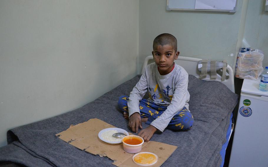 Saar, 10, eats lunch on his bed at the West Erbil Emergency Hospital on Saturday, March 11, 2017. His hands and face are blemished with fresh burns from an apparent chemical weapons attack in east Mosul earlier this month.