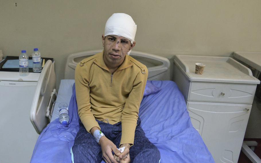 Recuperating in West Irbil Emergency Hospital in Iraq on March 11, 2017, Amar Khthair, 17, said he was injured in a coalition airstrike after Islamic State militants used his western Mosul home as a fighting position. He said 25 of his family members had been killed in the strike and he was the only survivor.