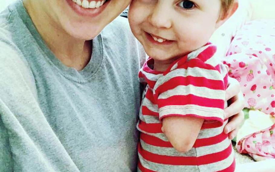 Katie Whiddon poses with her son, Camden, who was born with a rare condition that affects his limbs.