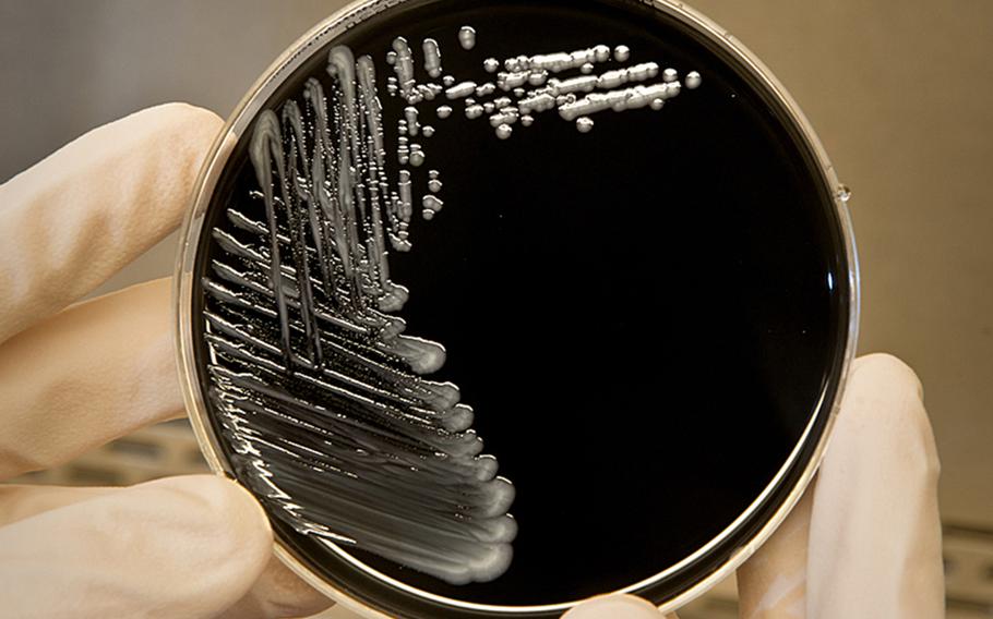 Legionella pneumophila, a bacterium that can cause Legionnaires' disease, growing on specialized microbiological media.