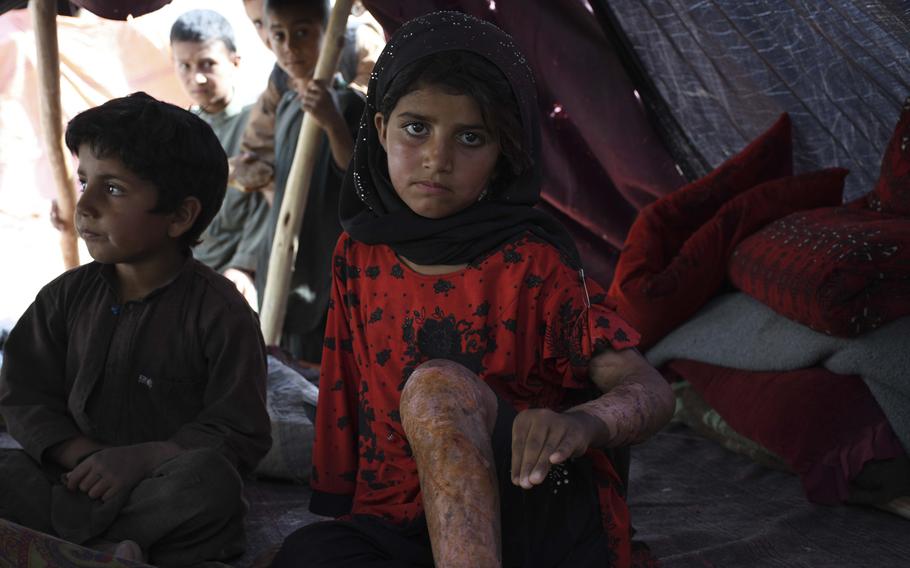 One month ago, Jamila, 9, fled with her mother and three siblings from drought-stricken Bala Murghab in Badghis province to camps on the outskirts of Herat. When she arrived, a stiff wind blew across the canvas tents of the camp and tilted boiling water on her legs, elders at the camp said. Approximately 20,000 Afghans displaced from their drought-ravaged farms in Ghor, Baghis and Faryab provinces fled to camps on the outskirts of Herat in the last month, where they await national and international aid.