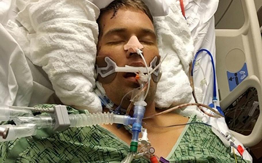 Former Marine Cpl. Bryant Scott nearly died from exertional heat stroke in July 2016 while on a land navigation course at Camp Pendleton, Calif. He was in a coma for two weeks and had to have a liver transplant. Despite policies and protocols to avoid heat illnesses, military experts say they are increasing.