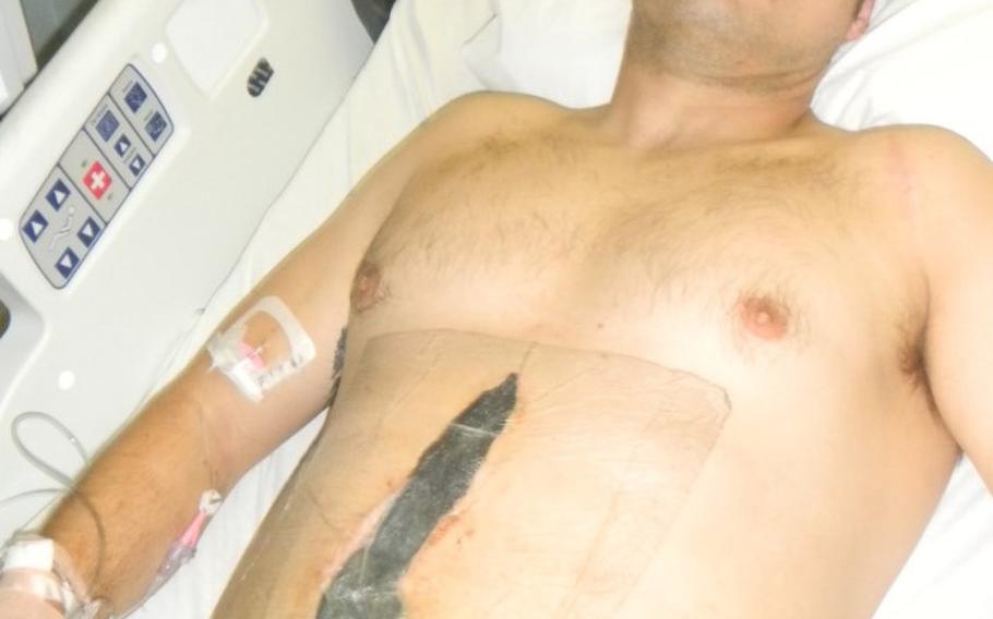 Staff Sgt. Kevin Flike recovers from a gunshot wound at Brooke Army Medical Center in San Antonio, Texas, in October 2011. Flike, 35, needed six surgeries as part of his recovery.